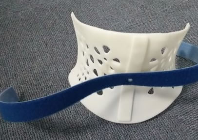 醫(yī)療3D打印機定制矯正器(圖2)